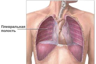 Plevralnaja-polost